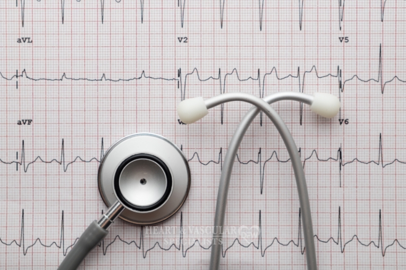 Irregular Heartbeats Explained: When Palpitations Need Evaluation in Flower Mound