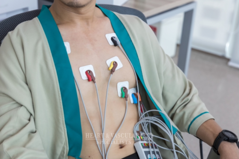 Irregular Heartbeats Explained: When Palpitations Need Evaluation in Flower Mound