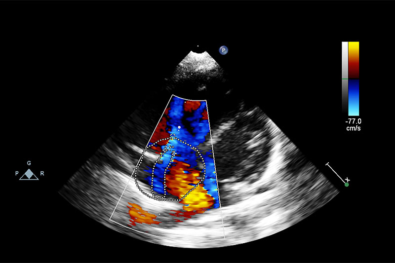 Advanced Imaging in Flower Mound