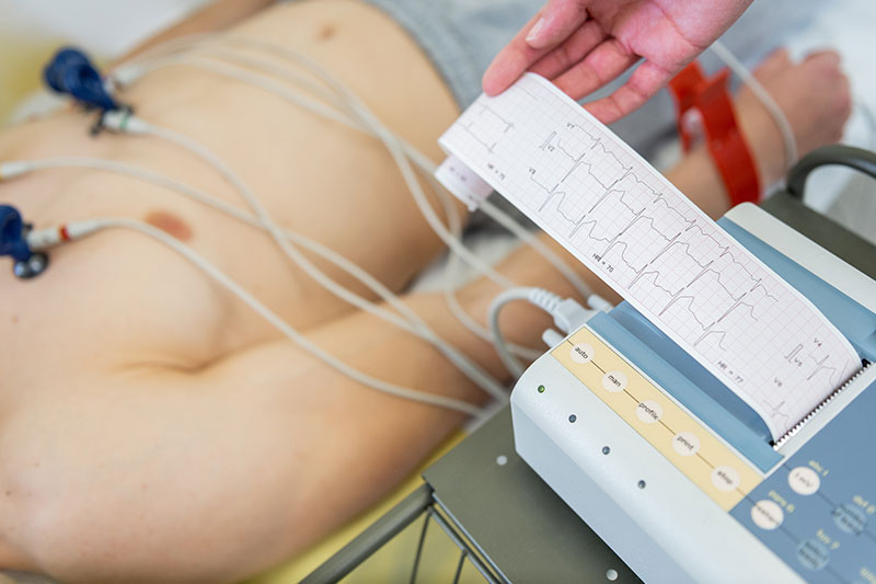 Electro-cardiogram (EKG/ECG) in Flower Mound